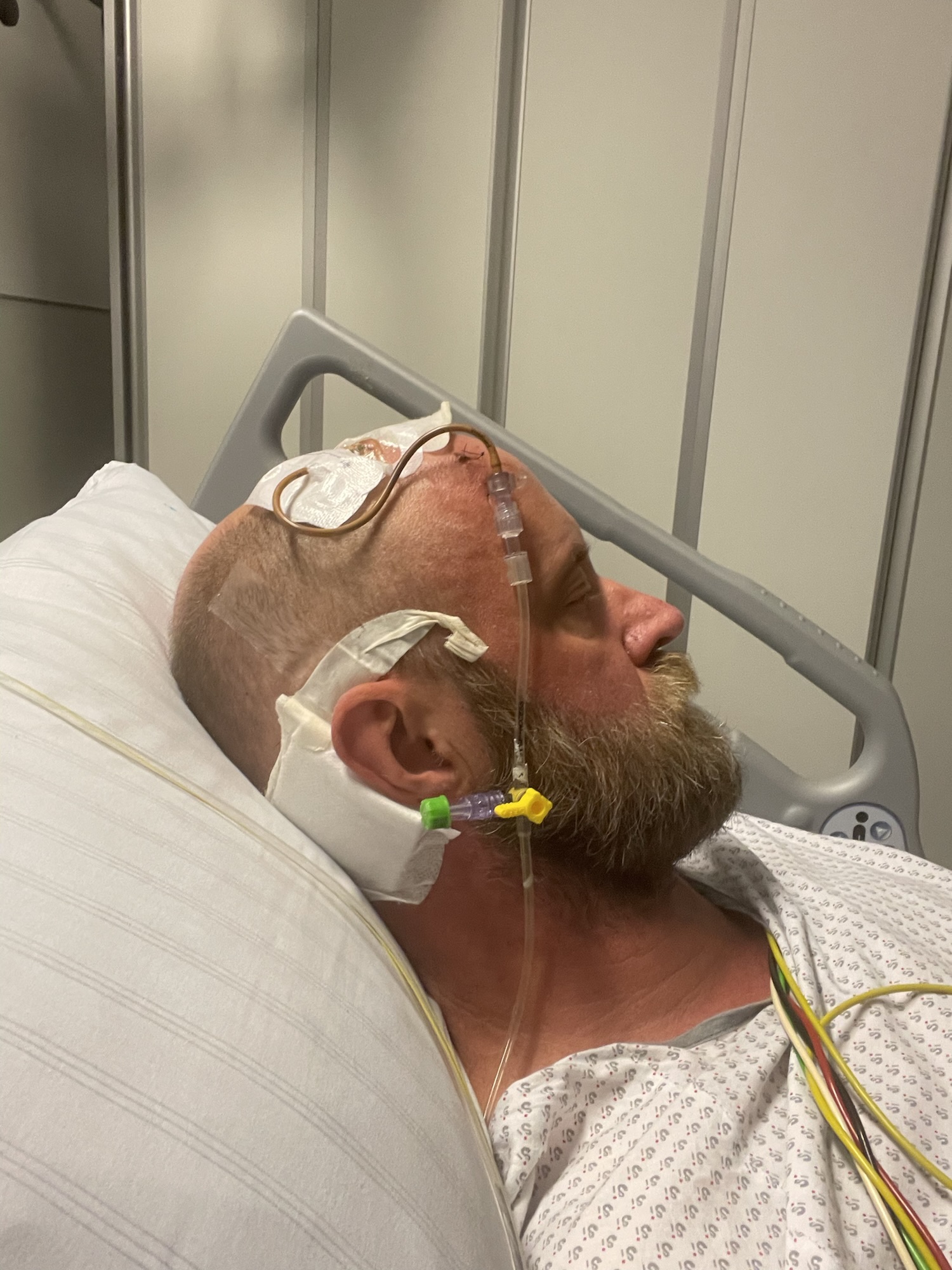 Was ein gutartiger Hirntumor mit meinem Coaching gemacht hat